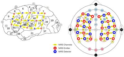 Differential cortical activation patterns: pioneering sub-classification of tinnitus with and without hyperacusis by combining audiometry, gamma oscillations, and hemodynamics